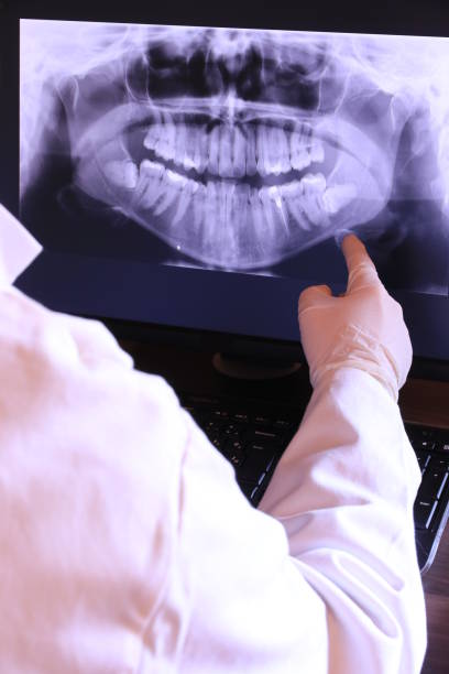 Best Emergency Tooth Extraction in Iota, LA