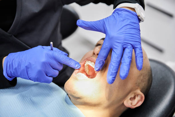 Best Emergency Broken Tooth Repair in Iota, LA